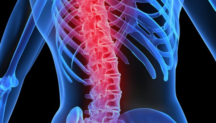 boli_v_spine_2-768x1024
