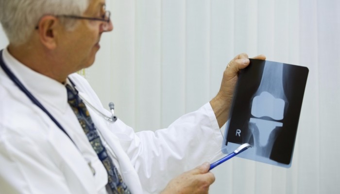 Doctor is examining X-ray image of artificial knee