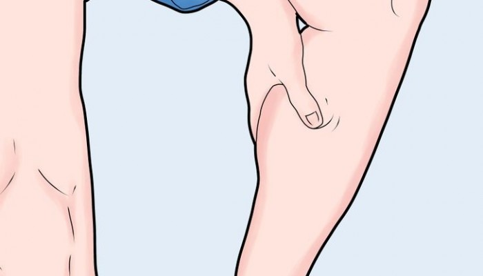 728px-Get-Rid-of-Shin-Splints-Fast-Step-1